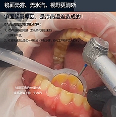 邦卡新型防霧吸水口鏡批發